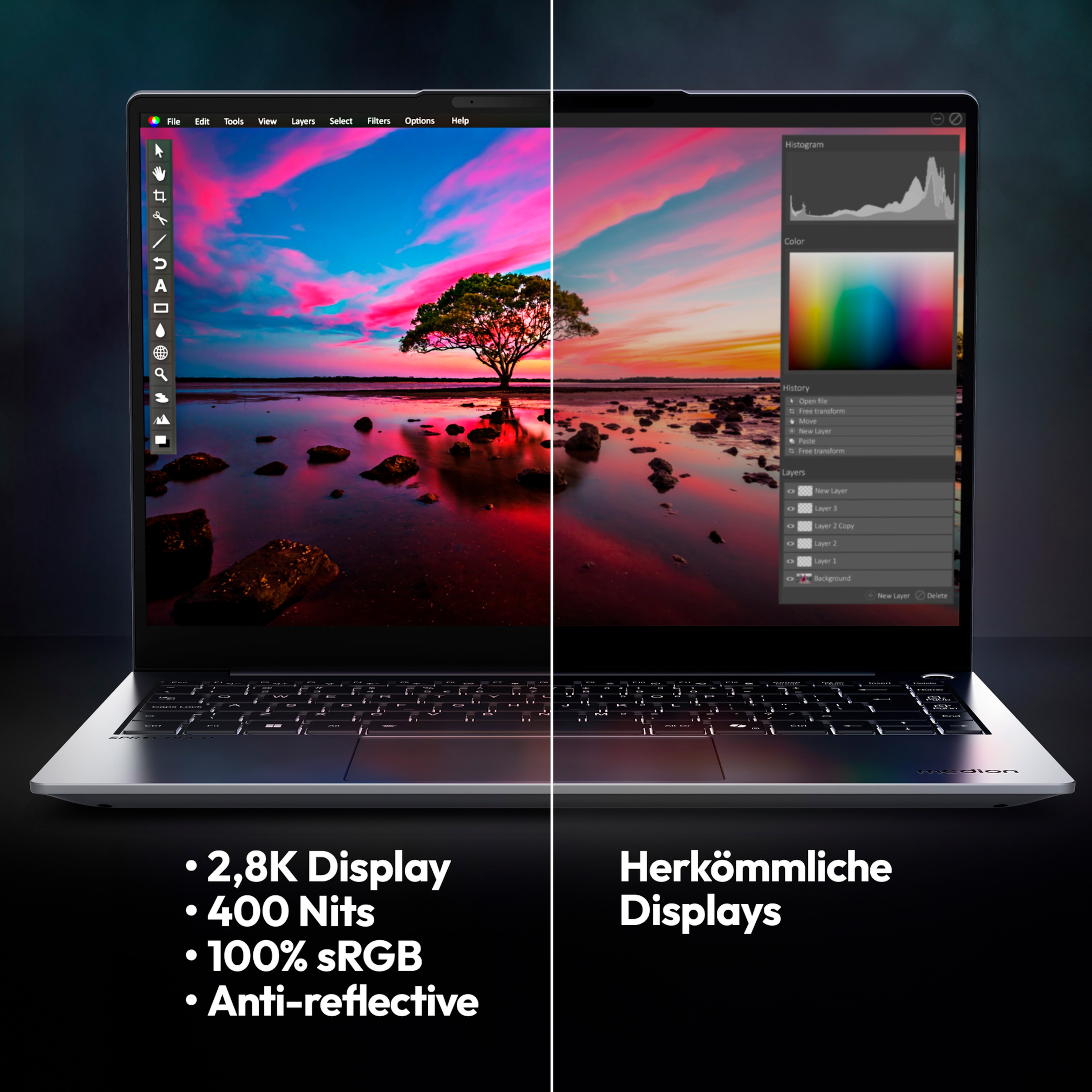 MEDION® SPRCHRGD 14 S2; Copilot+ PC, Intel® Core™ Ultra 7 258V , Windows 11 Home, 35,56 cm (14“) 2,8K Display, 1 TB SSD, 32 GB RAM